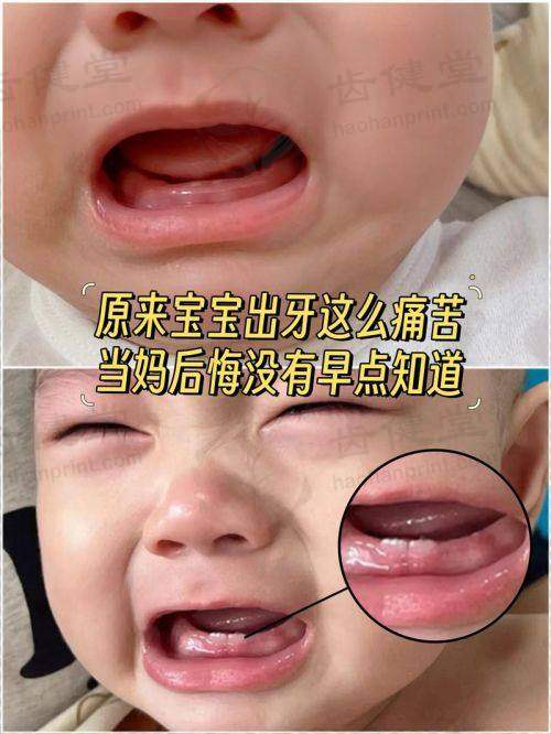 广东深圳言上口腔收费价格