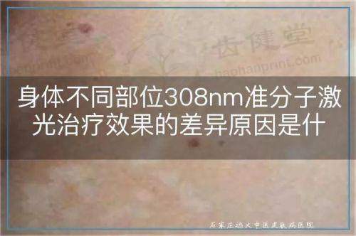 北京丰台医院眼科怎么样正规吗?