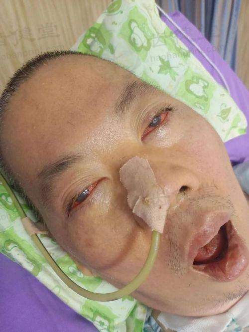 北京丰台医院眼科技术优势和特色项目