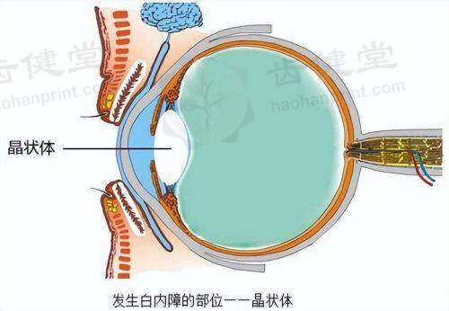 义乌视光眼科医院乘车路线：