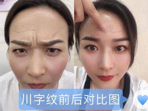患者真实评价