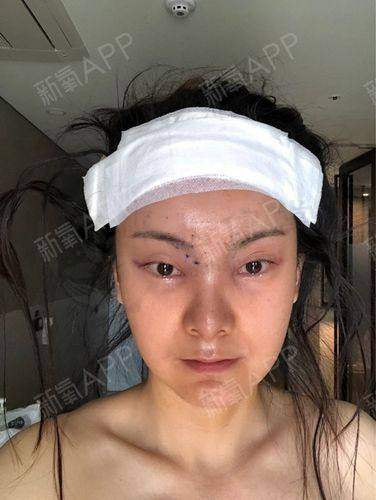 成都金牛科伊美医疗美容诊所口碑评价与实例分享