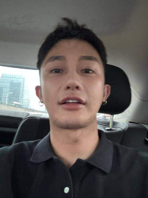 优惠活动详情
