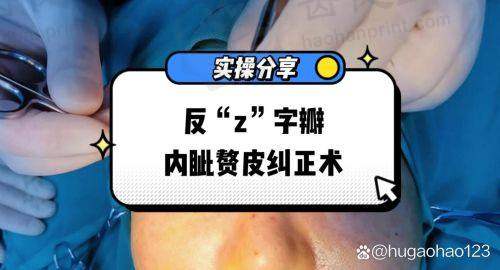 优惠活动详情