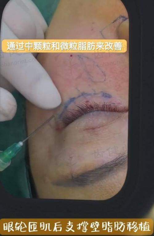 上海仁泉整形医院预约挂号