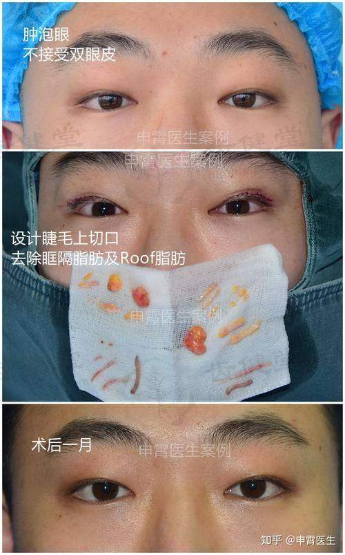 上海仁泉整形医院口碑评价与实例分享