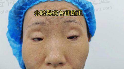 北京丰台医院眼科口碑评价与实例分享