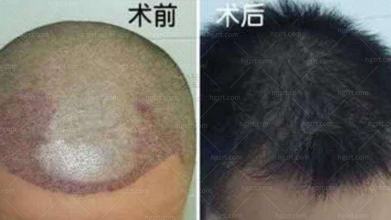 新疆整形美容医院乘车路线：
