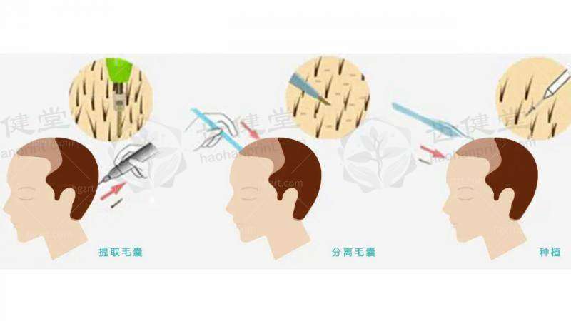 金东锡医生现目前就诊哪个医院？